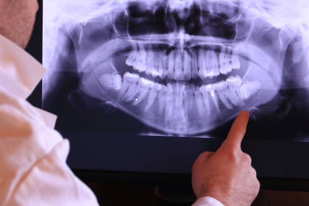 Best Root Canal Emergency Dentist  in Arcadia, IN